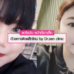 ลดไขมัน หน้าเรียวเล็กด้วยการฝังผลึกไหม by Dr.zen clinic